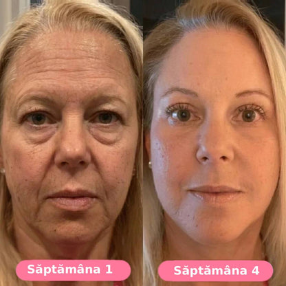Serum collagen