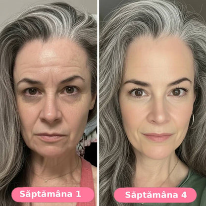 Serum collagen